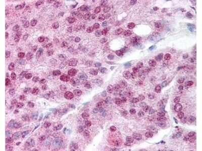 Immunohistochemistry: HSP90 alpha [ac Lys294] Antibody [NBP1-77944]
